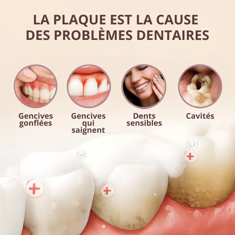 BodyAccel™ – Denti più bianchi in 7 giorni