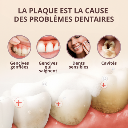 BodyAccel™ – Denti più bianchi in 7 giorni
